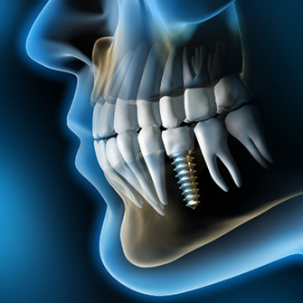 chirurgia dentale bologna