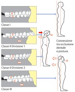 gnatologia posturale patologie dentali modificazioni occlusali e articolari bologna